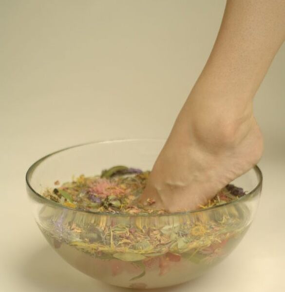 herbal bath for the treatment of nail fungus