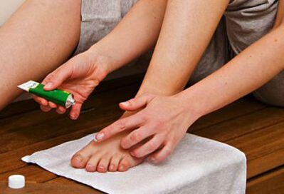 apply ointment to treat toenail fungus