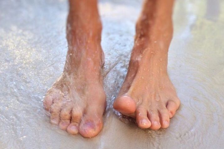 Walking barefoot is one way to contract nail fungus